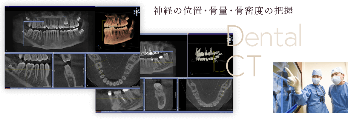 神経の位置・骨量・骨密度の把握