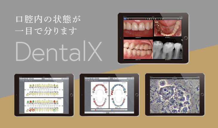 口腔内の状態が一目で分かります DentalX