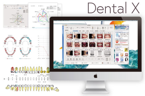 Dental X