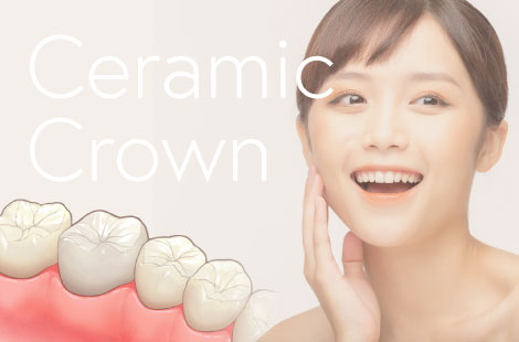 CeramicCrown