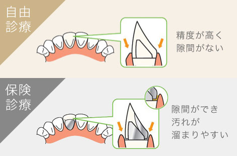 自由診療 保険診療