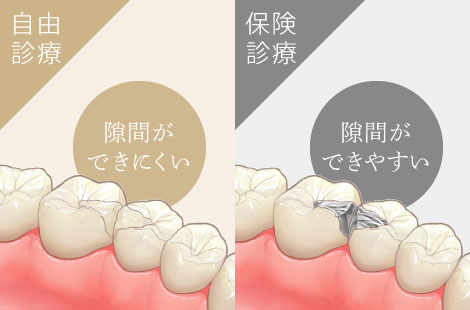 自由診療 j隙間ができにくい保険診療  隙間ができやすい